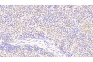 Detection of APBB1IP in Human Lymph node Tissue using Polyclonal Antibody to Amyloid Beta Precursor Protein Binding B1 Interacting Protein (APBB1IP)