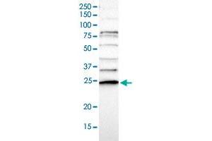 Western blot analysis of Human cell line RT-4 with CD34 polyclonal antibody  at 1:100-1:250 dilution. (CDC34 anticorps)