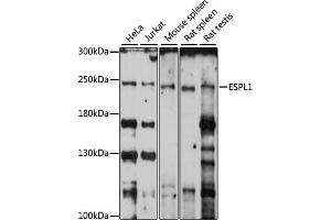 Western blot analysis of extracts of various cell lines, using ESPL1 antibody (ABIN7267070) at 1:1000 dilution. (Separase anticorps  (AA 1220-1500))