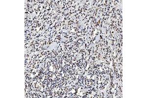 IHC analysis of SNRNP200 using anti-SNRNP200 antibody (ABIN7602032).