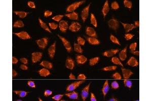 Immunofluorescence analysis of L929 cells using MARK2 Polyclonal Antibody at dilution of 1:100.