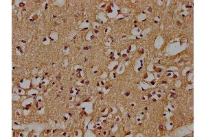 IHC image of ABIN7139735 diluted at 1:100 and staining in paraffin-embedded human brain tissue performed on a Leica BondTM system. (AXIN2 anticorps  (AA 56-73))