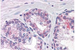 Human Prostate (formalin-fixed, paraffin-embedded) stained with PDE11A antibody ABIN337393 at 10 ug/ml followed by biotinylated anti-goat IgG secondary antibody ABIN481715, alkaline phosphatase-streptavidin and chromogen. (PDE11A anticorps  (AA 455-468))