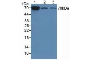 Detection of CHI3L1 in Mouse Liver Tissue, 2: Mouse Lung Tissue,3:Mouse Spleen Tissue using Polyclonal Antibody to Chitinase-3-like Protein 1 (CHI3L1) (CHI3L1 anticorps  (AA 112-356))