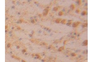 Detection of LDHB in Rat Brain Tissue using Polyclonal Antibody to Lactate Dehydrogenase B (LDHB)