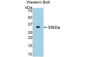 Western blot analysis of the recombinant protein. (NEK2 anticorps  (AA 148-397))