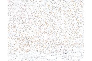 Immunohistochemistry (IHC) image for anti-Tripartite Motif Containing 28 (TRIM28) (AA 650-700) antibody (ABIN7453436) (KAP1 anticorps  (AA 650-700))
