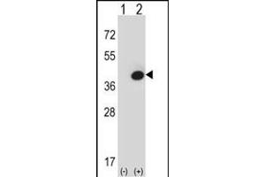Western blot analysis of FBP1 (arrow) using rabbit polyclonal FBP1 Antibody (Center) (ABIN391577 and ABIN2841512). (FBP1 anticorps  (AA 125-156))