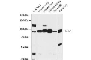 Western blot analysis of extracts of various cell lines, using EPN1 antibody (ABIN7267000) at 1:1000 dilution. (Epsin 1 anticorps  (AA 130-180))