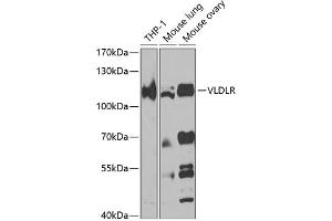 Western blot analysis of extracts of various cell lines, using VLDLR antibody (ABIN7271310) at 1:1000 dilution. (VLDLR anticorps  (AA 20-210))