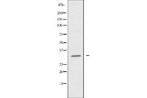 Western blot analysis of extracts from HeLa cells using Cytochrome c-type Heme Lyase antibody. (HCCS anticorps  (Internal Region))