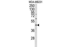 Western blot analysis of EGLN2 Antibody (Center) in MDA-MB231 cell line lysates (35ug/lane).