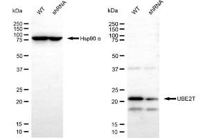 Western blotting analysis using UBE2T antibody (ABIN7800752).