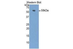 Western Blotting (WB) image for anti-Carboxypeptidase N Subunit 1 (CPN1) (AA 221-449) antibody (ABIN1858481) (CPN1 anticorps  (AA 221-449))