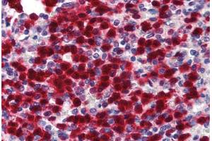 Human Spleen (formalin-fixed, paraffin-embedded) stained with CDA antibody ABIN293380 at 5 ug/ml followed by biotinylated goat anti-rabbit IgG secondary antibody ABIN481713, alkaline phosphatase-streptavidin and chromogen. (CDA anticorps  (N-Term))