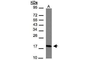 WB Image Sample(30 μg of whole cell lysate) A:Hep G2, 12% SDS PAGE antibody diluted at 1:1000 (CMTM6 anticorps  (C-Term))