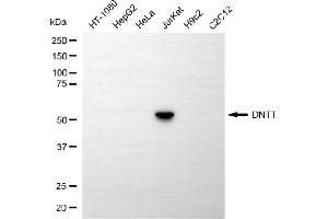 anti-Deoxynucleotidyltransferase, terminal (DNTT) antibody