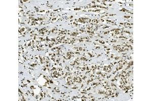 IHC analysis of PRDM5 using anti-PRDM5 antibody (ABIN7600853). (PRDM5 anticorps  (AA 24-630))