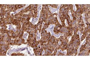 anti-E3 ubiquitin-protein ligase NEDD4-like (NEDD4L) (pSer448) antibody