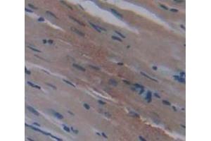 IHC-P analysis of Kidney tissue, with DAB staining. (METRN anticorps  (AA 22-291))