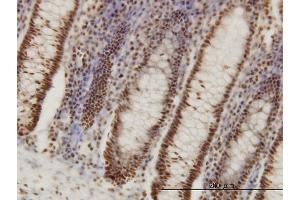 Immunoperoxidase of monoclonal antibody to PPIG on formalin-fixed paraffin-embedded human colon.