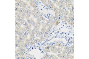 Immunohistochemistry of paraffin-embedded rat liver using PYCR1 antibody at dilution of 1:200 (40x lens). (PYCR1 anticorps)