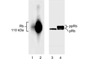 Western Blotting (WB) image for anti-Retinoblastoma 1 (RB1) (AA 514-610), (underphosphorylated) antibody (ABIN967418) (Retinoblastoma 1 anticorps  (underphosphorylated))