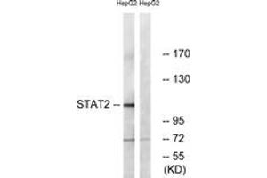 Western blot analysis of extracts from HepG2, using STAT2 (Ab-690) Antibody. (STAT2 anticorps  (AA 656-705))