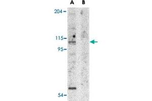 Western blot analysis of APAF1 in K-562 cell lysate with APAF1 polyclonal antibody  at 1 ug/mL in the (A) absence and (B) presence of blocking peptide. (APAF1 anticorps  (N-Term))