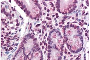 Small intestine, Human: Formalin-Fixed, Paraffin-Embedded (FFPE) (TMPRSS4 anticorps  (Internal Region))