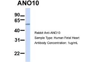 Host:  Rabbit  Target Name:  ANO10  Sample Type:  Human Fetal Heart  Antibody Dilution:  1. (Anoctamin 10 anticorps  (C-Term))