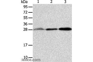 Western blot analysis of Human fetal liver and seminoma tissue, RAW264. (ALKBH2 anticorps)
