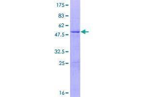 Image no. 1 for Ring Finger Protein 166 (RNF166) (AA 1-237) protein (GST tag) (ABIN1318283)