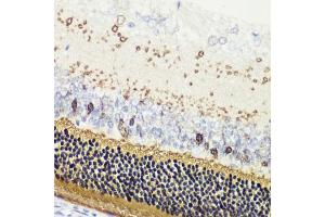 Immunohistochemistry of paraffin-embedded rat retina using RCVRN antibody (ABIN6128676, ABIN6146832, ABIN6146833 and ABIN6222036) at dilution of 1:200 (40x lens).