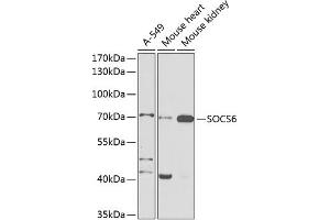 Western blot analysis of extracts of various cell lines, using SOCS6 antibody (ABIN6128785, ABIN6148273, ABIN6148274 and ABIN6225294) at 1:1000 dilution. (SOCS6 anticorps  (AA 1-210))