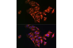 Immunofluorescence analysis of U2OS cells using Fatty Acid Synthase (FASN) Rabbit pAb (ABIN3020990, ABIN3020991, ABIN3020992 and ABIN6213855) at dilution of 1:100 (40x lens).