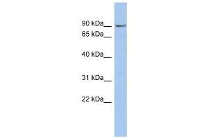 NPHP1 antibody used at 1 ug/ml to detect target protein. (NPHP1 anticorps)