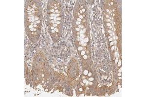Immunohistochemical staining of human appendix with KCMF1 polyclonal antibody  shows moderate cytoplasmic positivity in glandular cells at 1:200-1:500 dilution. (KCMF1 anticorps)