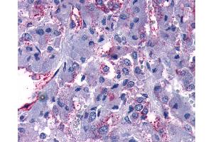 Anti-GPR108 antibody IHC of human adrenal. (GPR108 anticorps  (Cytoplasmic Domain))