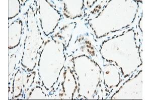 Immunohistochemistry (IHC) image for anti-Ubiquitin Specific Peptidase 5 (USP5) antibody (ABIN1501693)