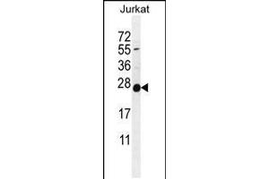 Western blot analysis in Jurkat cell line lysates (35ug/lane). (POLR2J anticorps  (C-Term))