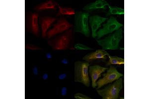 ABIN6259757 and ABIN6276478 staining  cells by IF/ICC. (ACTR3 anticorps  (C-Term))