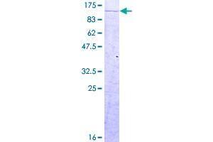 Image no. 1 for Cleavage and Polyadenylation Specific Factor 2, 100kDa (CPSF2) (AA 1-782) protein (GST tag) (ABIN1350229)