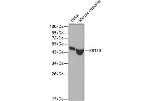 Western blot analysis of extracts of various cell lines using KRT20 Polyclonal Antibody. (KRT20 anticorps)