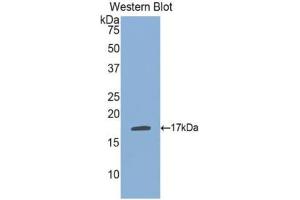 Western blot analysis of the recombinant protein. (PLA1A anticorps  (AA 148-295))
