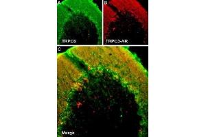 Colocalization of TRPC6 and TRPC3 in rat cerebellum - Immunohistochemical staining of rat cerebellum frozen section using Guinea pig Anti-TRPC6 Antibody (ABIN7043826, ABIN7045362 and ABIN7045363) and rabbit Anti-TRPC3-ATTO Fluor-594 Antibody (ABIN7043819).