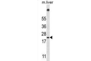 Western Blotting (WB) image for anti-Ubiquitin-Conjugating Enzyme E2W (UBE2W) antibody (ABIN2997430) (UBE2W anticorps)