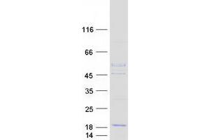 Validation with Western Blot