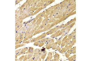 Immunohistochemistry of paraffin-embedded rat heart using PEX5 antibody (ABIN6133015, ABIN6145469, ABIN6145471 and ABIN6221464) at dilution of 1:100 (40x lens).