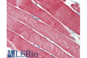 ABIN5539515 (5µg/ml) staining of paraffin embedded Human Skeletal Muscle.